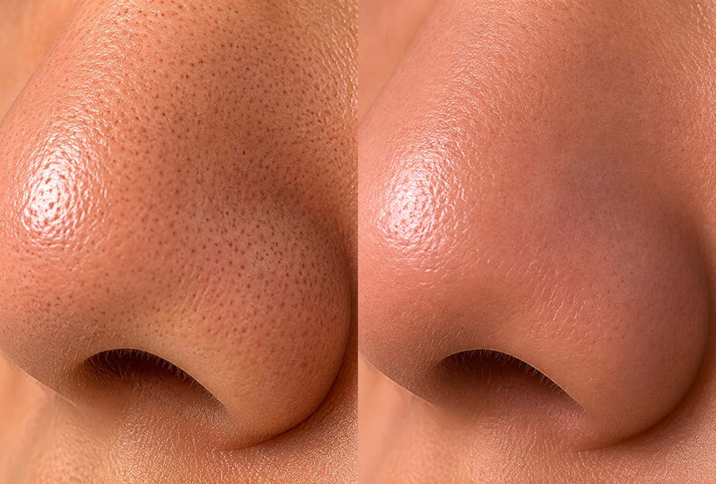 Vorher – Aqua Precision Pro